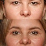 Nouveau chirurgien esthétique à Lausanne