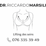 Lifting des seins à Lausanne : FAQ complet
